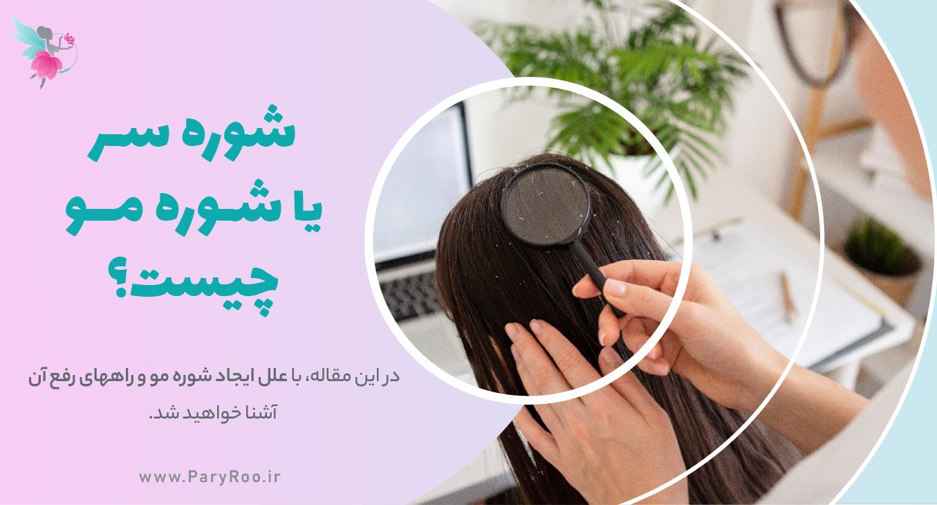 شوره سر یا شوره مو چیست؟ | پری رو