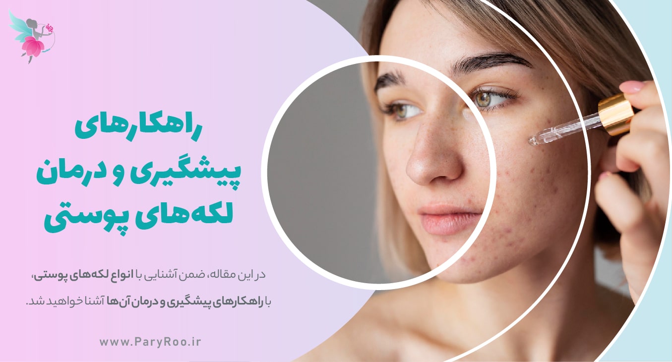 بهترین راهکارهای پیشگیری و درمان انواع لکه های پوستی | پری رو