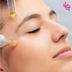 روش های جوانسازی پوست-میکرونیدلینگ میکرونیدلینگ جوانسازی پوست | پریرو