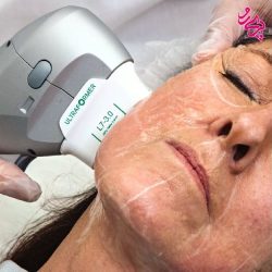 روش های جوانسازی پوست-هایفوتراپی HIFU هایفوتراپی HIFU | پری رو