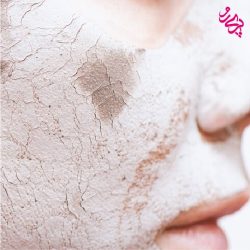 پوست خشک پوست خشک | پری رو