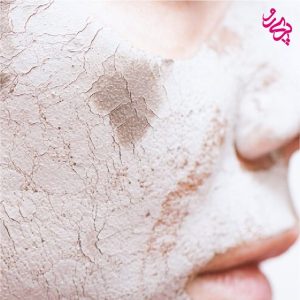 پوست خشک پوست خشک | پوست خشک چگونه است | پری رو