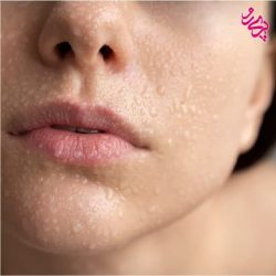 کنترل چربی پوست کنترل چربی پوست برای آبرسانی بهتر | سایت زیبایی پری رو